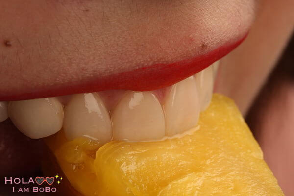 牙齒黃-牙齒美白-陶瓷貼片術後-上排門牙藝術照-3-沈志容醫師-桃園