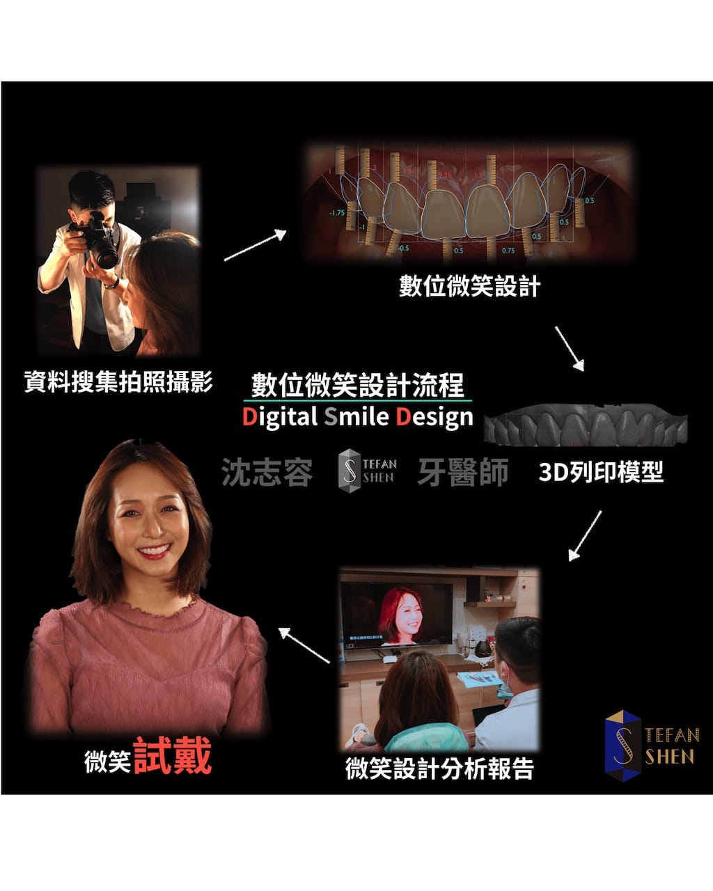 DSD數位微笑設計流程