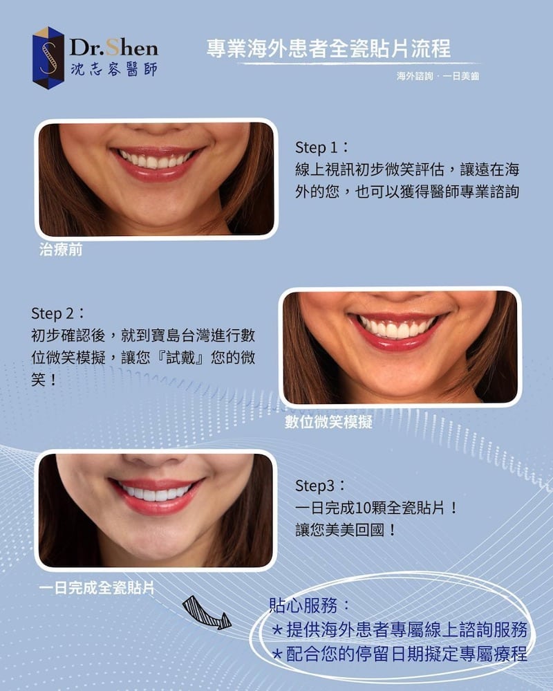 香港空服員-瓷牙貼片-陶瓷貼片-海外患者專屬陶瓷牙貼流程-沈志容醫師-台灣-桃園-當代牙醫