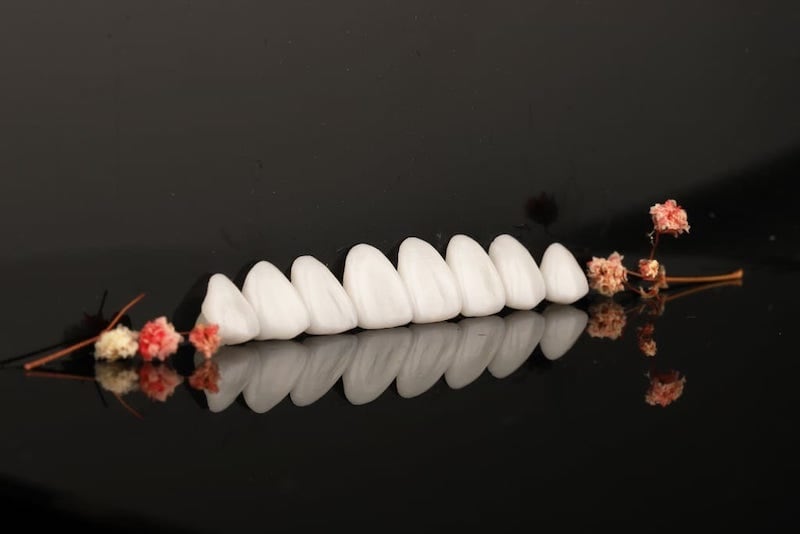 瓷牙貼片流程-一日美齒-海外牙齒美白推薦牙醫-沈志容醫師-製作完成的瓷牙貼片