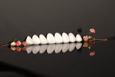 瓷牙貼片價格-牙齒貼片缺點-牙齒美白推薦診所選擇-經由顯微微創研磨後製作的瓷牙貼片-feature-image