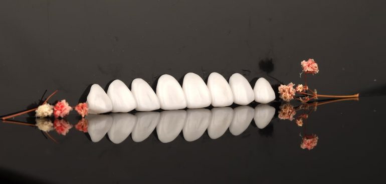 瓷牙貼片價格-牙齒貼片缺點-牙齒美白推薦診所選擇-經由顯微微創研磨後製作的瓷牙貼片-feature-image
