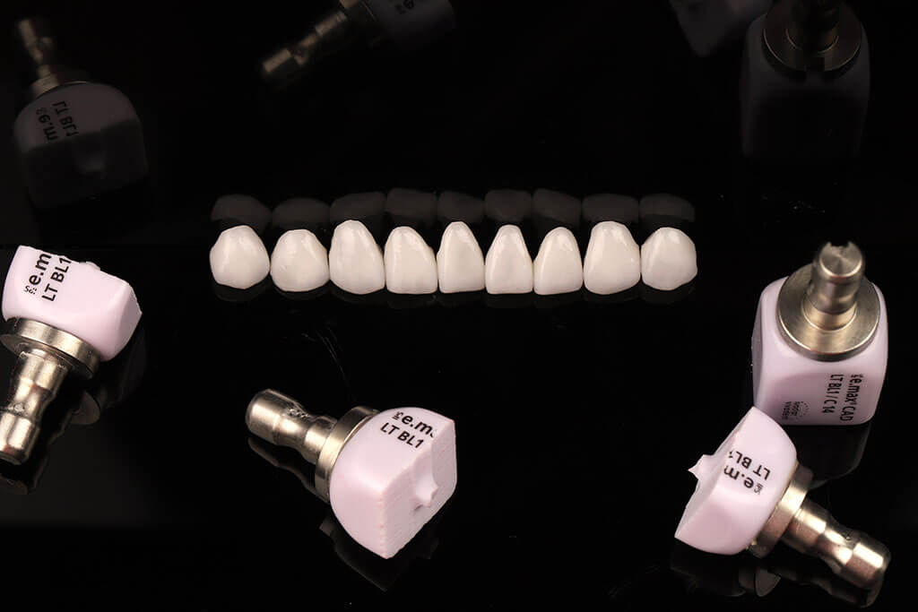 陶瓷貼片價格-牙齒貼片-瓷牙貼片-牙齒美白推薦-每一顆硨完的陶瓷料塊皆無法再重新使用