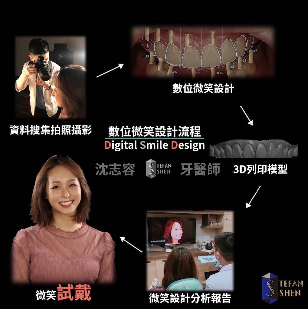 陶瓷貼片-推薦-桃園牙齒美白-沈志容醫師-DSD數位微笑設計流程圖