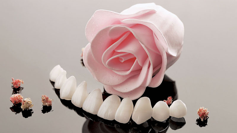陶瓷貼片-牙齒貼片失敗-高度擬真的陶瓷牙齒貼片-沈志容醫師-桃園