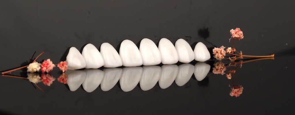 瓷牙貼片價格-牙齒貼片缺點-牙齒美白推薦診所選擇-經由顯微微創研磨後製作的瓷牙貼片-2022