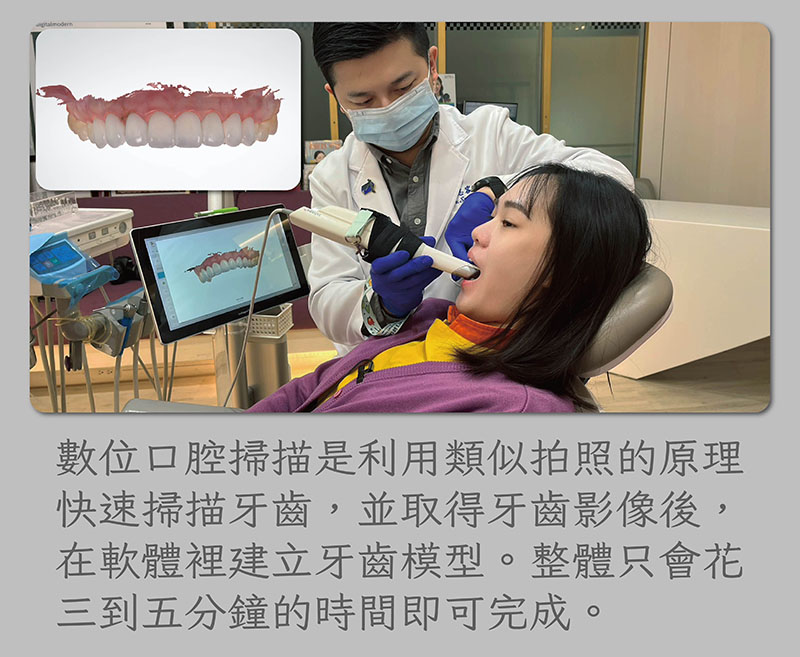 數位口腔掃描可在3~5分鐘快速取得牙齒模型，有較高的舒適度與精準度