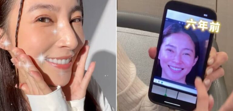 張元美-張家瑋牙齒-明星牙齒-陶瓷貼片-桃園牙齒美白推薦-沈志容醫師