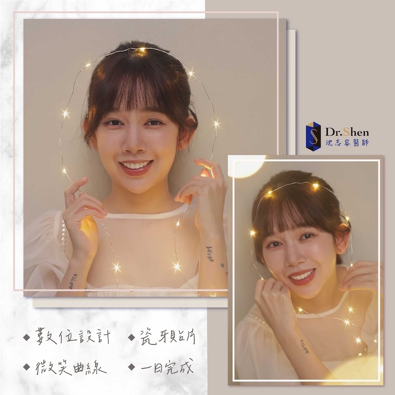 冷光美白-陶瓷貼片-牙齒美白-微笑設計-療程後笑容-3-沈志容醫師-桃園 完成陶瓷貼片療程,羚安露出自然亮白的自信笑容