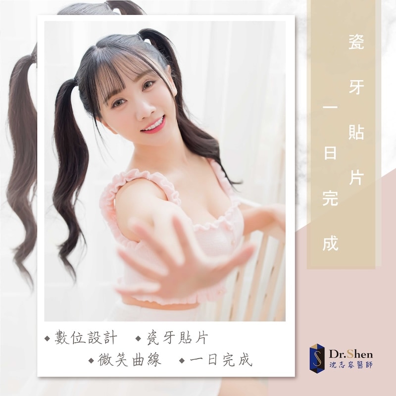 牙齒不對稱-牙齒亂-陶瓷貼片-味全龍啦啦隊-小珍奶-療程後笑容-6-沈志容醫師-桃園 味全龍啦啦隊小珍奶笑容特寫,完成陶瓷貼片後展現自然透亮牙齒與自信甜美氣質