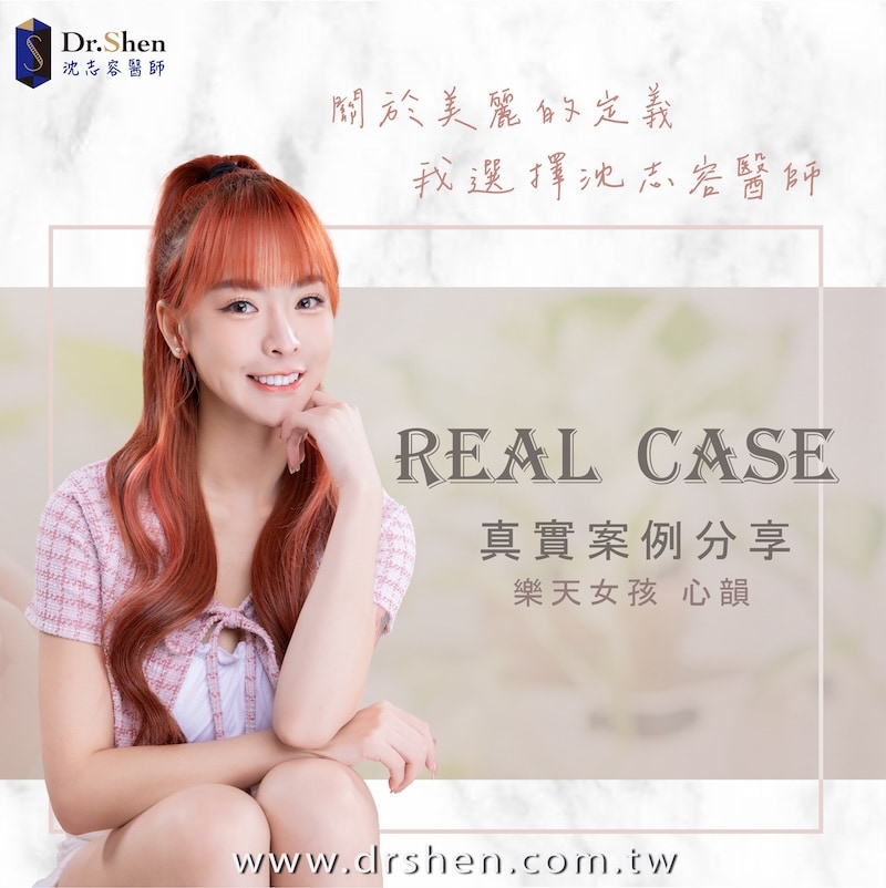 樂天女孩心韻完成陶瓷貼片後露出自然自信笑容，展現白皙整齊的牙齒與迷人微笑曲線