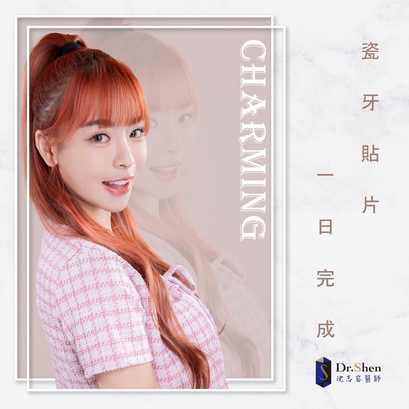 樂天女孩心韻完成陶瓷貼片後露出自然自信笑容，展現白皙整齊的牙齒與迷人微笑曲線