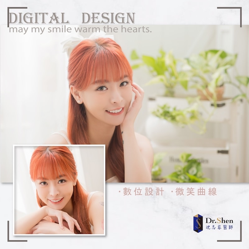 樂天女孩心韻完成陶瓷貼片後露出自然自信笑容，展現白皙整齊的牙齒與迷人微笑曲線