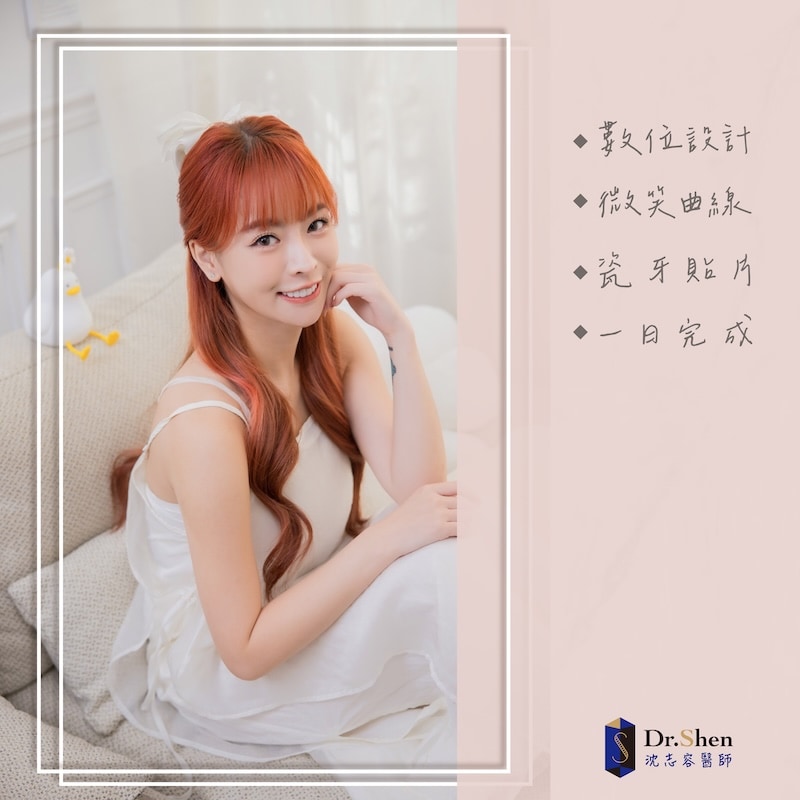 樂天女孩心韻完成陶瓷貼片後露出自然自信笑容，展現白皙整齊的牙齒與迷人微笑曲線