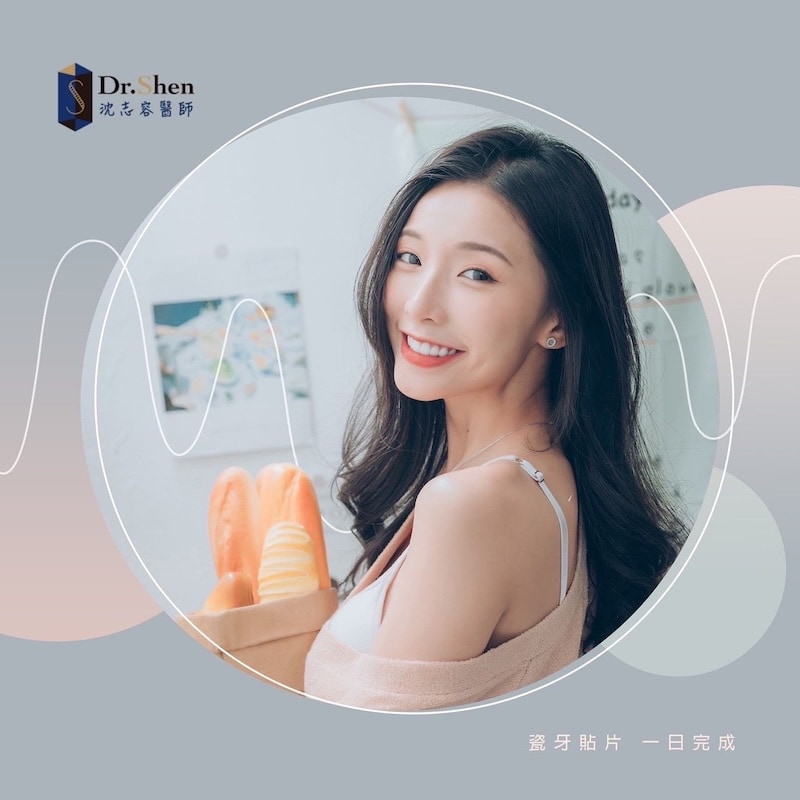 陶瓷貼片-補牙染色-二次蛀牙-牙齒黃-蕭芷渲-療程後笑容-4-沈志容醫師-桃園 蕭芷渲完成陶瓷貼片後自信露齒笑,展現白皙整齊、自然透亮的微笑曲線