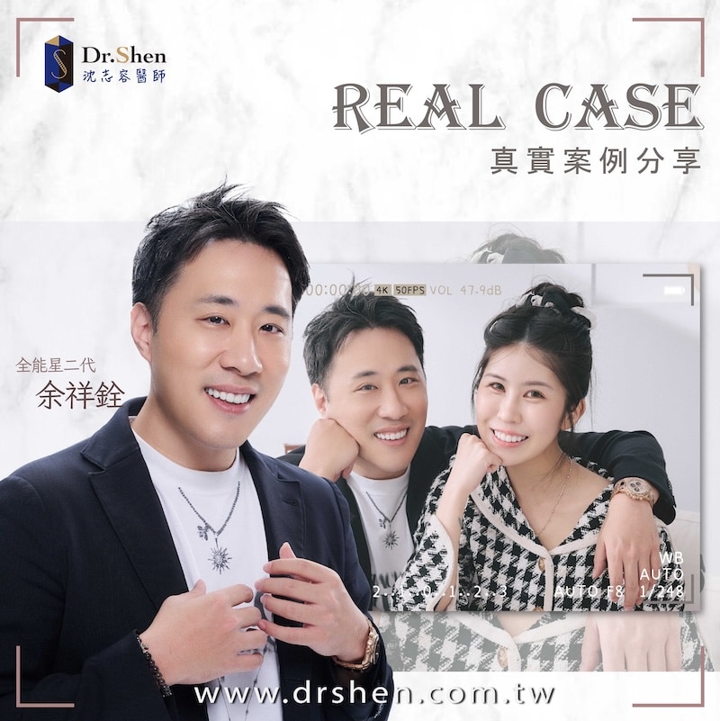 明星余祥銓與老婆柔柔完成陶瓷貼片療程後，露出白皙透亮的自信笑容