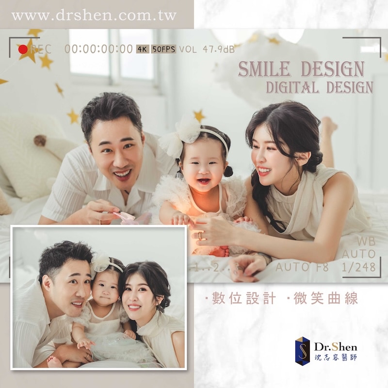 明星余祥銓與老婆柔柔完成陶瓷貼片療程後，露出白皙透亮的自信笑容