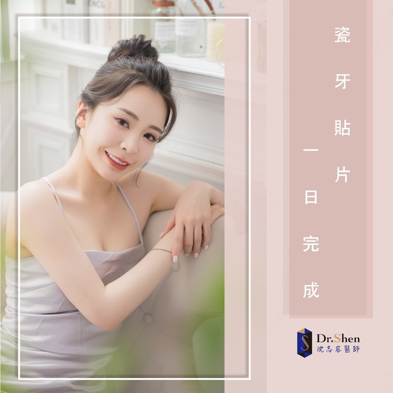 直播主思辰完成陶瓷貼片療程，露出自信燦爛笑容與自然透亮牙齒