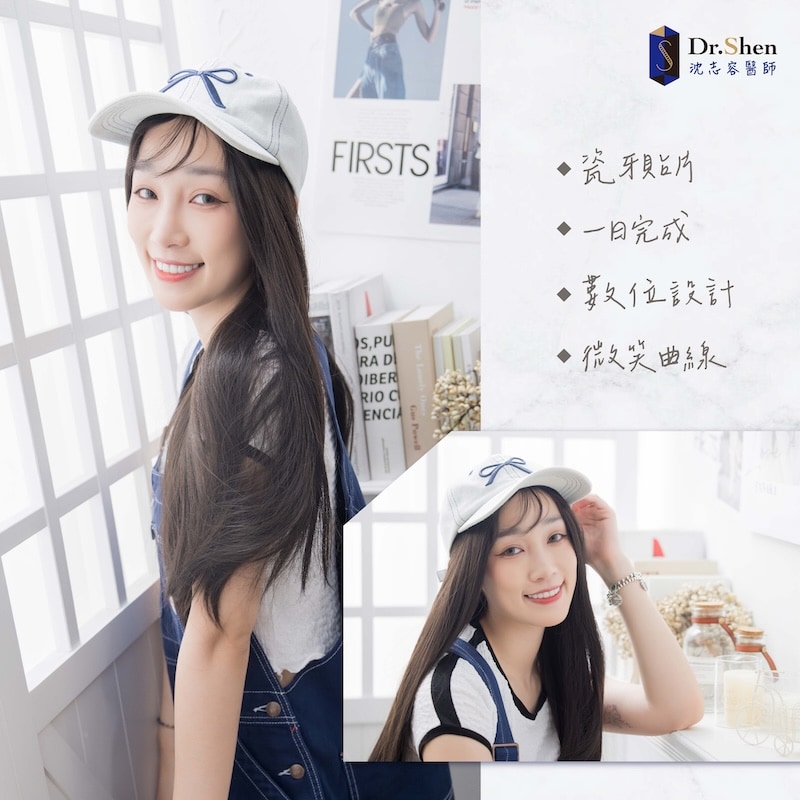 牙齒大小不一-牙齒不對稱-牙齒黃-陶瓷貼片-劉萱IRIS-療程後笑容-3-沈志容醫師-桃園 遊戲實況主劉萱完成陶瓷貼片療程後的笑容,牙齒色澤自然透亮、齒型對稱整齊,呈現自信迷人的微笑曲線