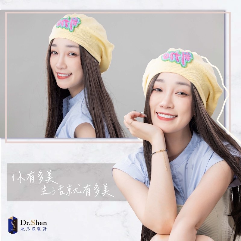 牙齒大小不一-牙齒不對稱-牙齒黃-陶瓷貼片-劉萱IRIS-療程後笑容-5-沈志容醫師-桃園 遊戲實況主劉萱完成陶瓷貼片療程後的笑容,牙齒色澤自然透亮、齒型對稱整齊,呈現自信迷人的微笑曲線