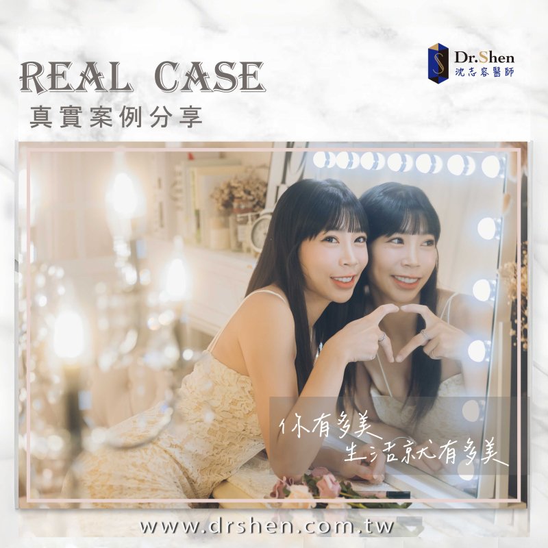牙齒小-牙齒不對稱-陶瓷貼片-夢想家啦啦隊-梁媛媛-療程後笑容-1-沈志容醫師-桃園 夢想家啦啦隊梁媛媛完成陶瓷貼片與牙齦微整,開心露出潔白對稱笑容