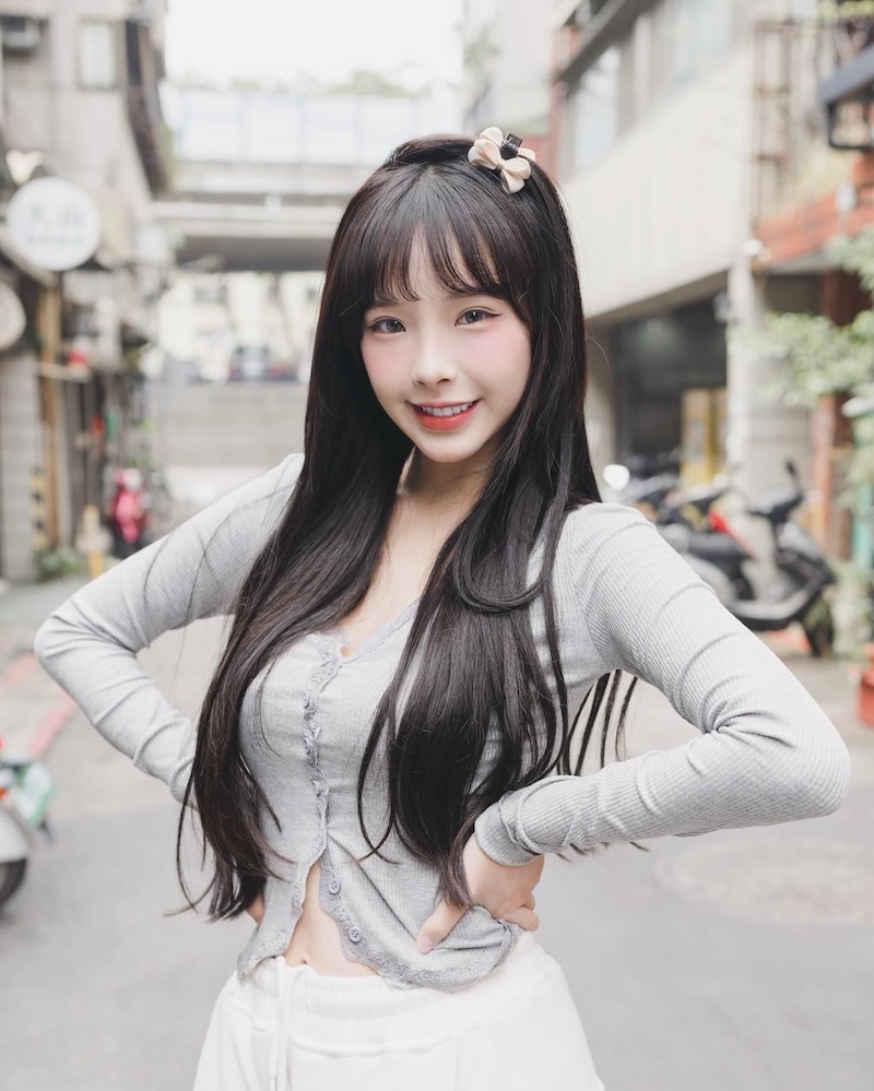 Vicky教主黃玟綺陶瓷貼片術後笑容照