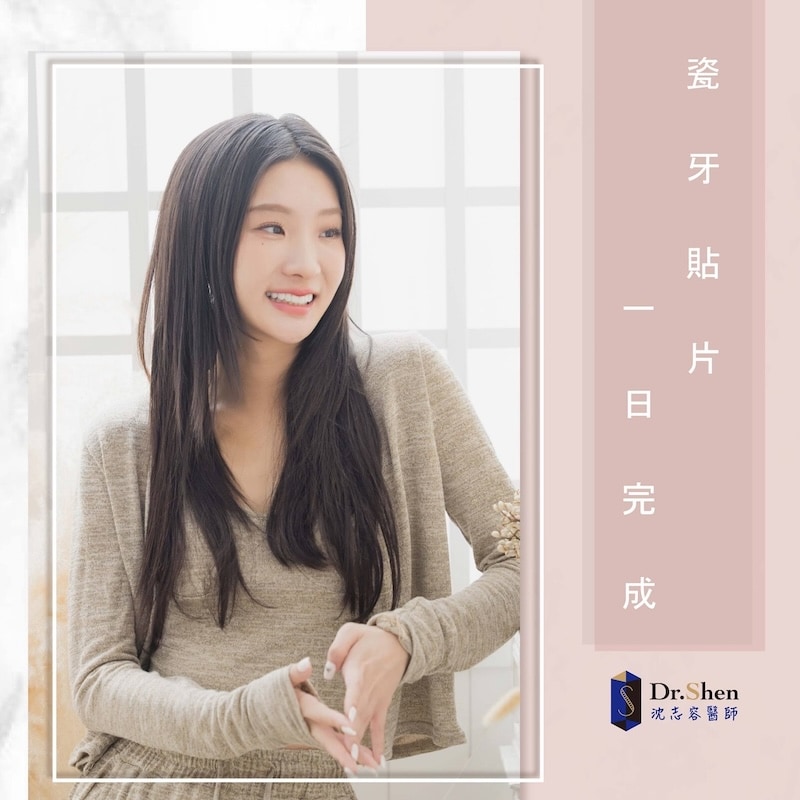 牙齒大小不一-牙齒美白-陶瓷貼片-陳華-療程後笑容-4-沈志容醫師-桃園 創作歌手陳華完成陶瓷貼片後展現自然自信笑容