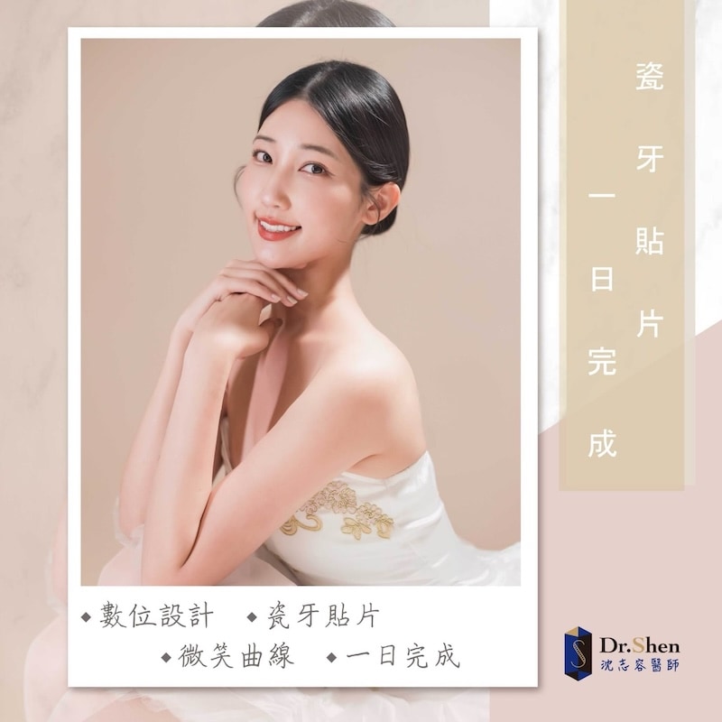 門牙縫隙-牙齒顏色不均-陶瓷貼片-空服員-林語安-療程後笑容-6-沈志容醫師-桃園 前空服員林語安完成陶瓷貼片後展現自然自信笑容